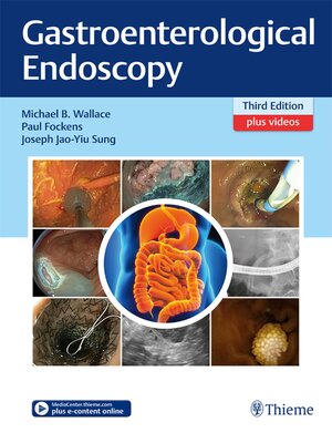 cover image of Gastroenterological Endoscopy